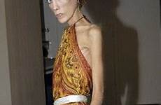 anorexic model fashion caro shock anorexia campaign who dies isabelle appeared french body italian 2007 died dailymail pictured battle had