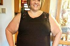 mother obese sugar excess launched removal fundraising pay campaign try skin she help her