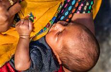 breastfeeding newborns improve feeding lshtm differs