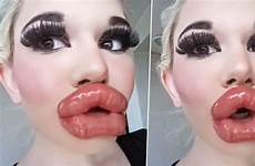 lip injection filler soundpasta bulgarian barbie