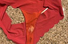 stains underwear discharge vaginal crotch prevent bleach bleached thongs underwears