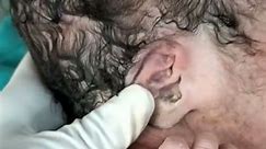 heariy baby after birth moment #newbornbaby #babyshorts #nicubaby #bornebaby #cute #viralvideo #baby
