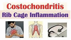 Costochondritis (Rib Cage Inflammation) | Causes, Symptoms, Diagnosis, Treatment