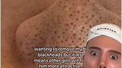 CRAZY BLACKHEAD REMOVAL!😱 (follow for more💗) #skincare #skin #beauty #beautytips #acne #blackheads