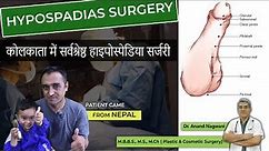 Best HYPOSPADIAS Surgery in Kolkata | Patient Came from Nepal | Best Age for Hypospadias Surgery