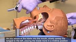 Anestesiologia - McGRATH™ MAC Video Laryngoscope