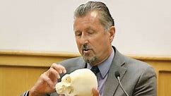 Defense expert offers differing views about skull wounds in Redwine case