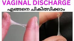 All about VAGINAL DISCHARGE- causes and remedies