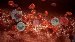 Understanding hemophilia