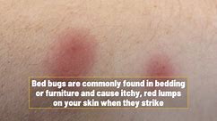How To Identify And Get Rid Of Bedbugs