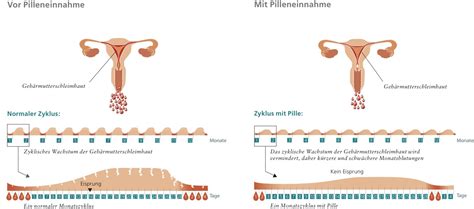 We did not find results for: Keine blutung in pillenpause. darf die regel in der ...