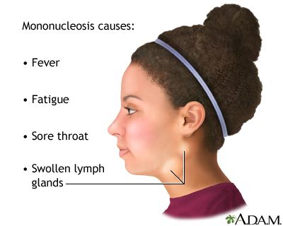 Mono is an infection caused by a virus. Infectious mononucleosis: MedlinePlus Medical Encyclopedia ...