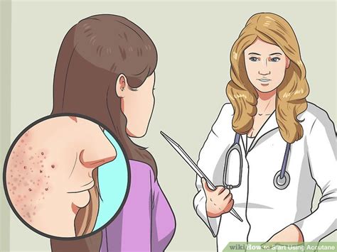 When to seek the dermatologist for acne nodules? How to Start Using Accutane (with Pictures) - wikiHow