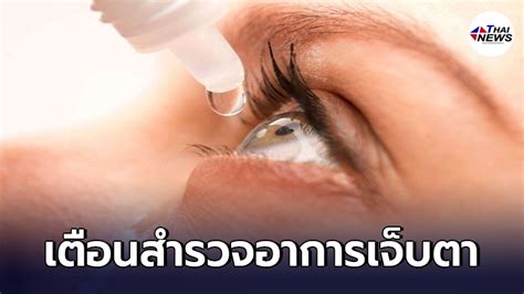 หลังจาก กระทรวงสาธารณสุข ออกมาเปิดเผยว่า อาการของโรคโควิดระลอกใหม่ มีการตาแดง ผื่น รพ.จุฬาลงกรณ์ ได้แนะนำวิธีการสังเกต ผื่นโควิด ไว้ว่า จักษุแพทย์ เตือนปชช.สำรวจตัวเอง เจ็บตาแบบไหน เข้าข่ายติดโค ...