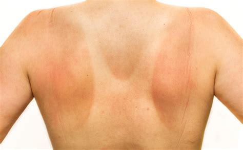 Well, up until junior year when i made the dumb decision to switch to tanning beds… How to Get Rid of Tan Lines - EcoSalon
