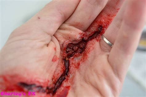 Hand laceration : sfx