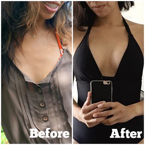Wash hands and other exposed areas with mild soap and water before eating, drinking or smoking and when leaving work. Breast surgery before and after pictures