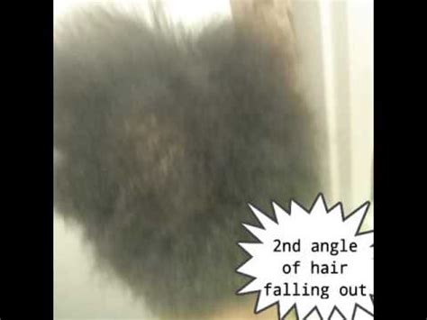 Fluocinonide! The fastest hair growing steroid! - YouTube