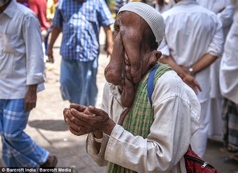 Ndovu hao wote wakiwa viongozi wa familia zao mara nyengine husalia macho kwa siku kadhaa na huonekana wakifunga macho ama kuota mara moja kila siku tatu. Shukuru Ulivyoumbwa: Kutana Na Mwanamume Ambaye Ana Sura ...