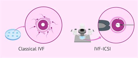 I wanted to post here to answer questions anyone might how did you get introduced to donating your eggs? ICSI Success Rates Compared to IVF Treatment - Which Is ...