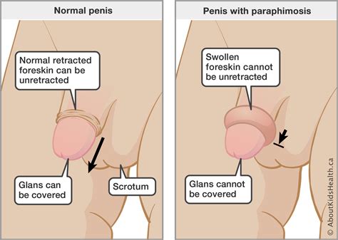 Dot number, short for department of transportation number, is a number assigned to commercial vehicles by the federal motor carrier safety association once you collect the above information, you need to proceed and start filling the application. What does it feel like to have a foreskin ...