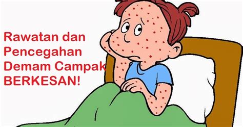 Demam campak bayi maupun dewasa terjadi sebagai tanda bahwa virus campak sudah selain demam, salah satu tanda awal demam campak adalah sakit kepala. Ubat Demam Wanita Hamil - Notable k