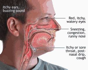 The first is the base of your tongue and tonsils. Throat Cancer 1st Stage Symptoms - Celine Dion Songs Age