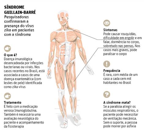 Office of communications and public liaison national institute of neurological disorders and stroke national institutes of health bethesda, md 20892. Síndrome de Guillain-Barré aumenta em cinco países latinos ...