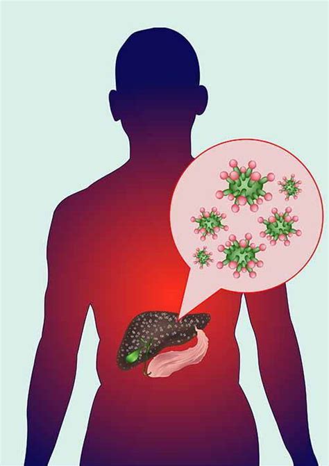 Epatite C: sintomi, cause e modalità di contagio - GreenMe.it