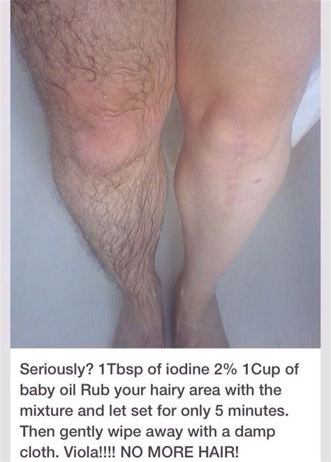 We did not find results for: How to get rid of hair without shaving - MISHKANET.COM