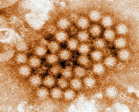 Norovirus adalah virus rna tunggal terkandas, yang dipunyai oleh keluarga caliciviridae dan bertanggungjawab terhadap patogenesis berjangkit makanan gastroenteritis. Norovirus infeksi gambar gratis, gambar domain publik