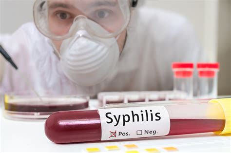 Maybe you would like to learn more about one of these? Congenital Syphilis Is On The Rise | The Pulse