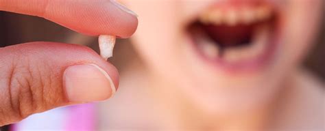 One effective way to stabilize a loose tooth is to attach a splint to its surface, which is also bonded to the stable teeth nearby. Your Child's First Loose Tooth - Renken Dentistry
