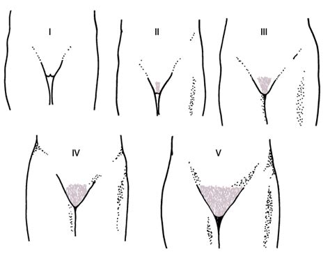 Concerns about possible early pubertal development are a common cause for referral to pediatric medical subspecialists. Female Reproductive Endocrinology - Gynecology and ...