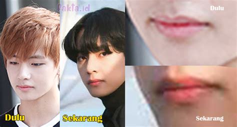 Iphone 7 dirilis tepat setahun setelah iphone 6s. Apakah Bibir V BTS Oplas? Coba Lihat Perbandingan Dulu dan Sekarang - Fakta.id