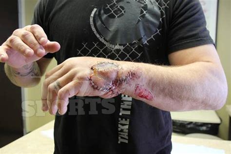 For jp.50 cals, they do almost the same damage as breda. New, disgusting photos surface of Joe Riggs hand post ...