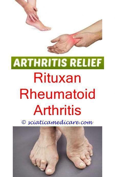 Maybe you would like to learn more about one of these? Pin on Symptoms Of Arthritis