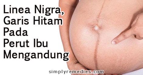 Linea nigra adalah sebuah garis hitam atau cokelat pekat yang membentang secara vertikal di atas perut ibu hamil yang biasanya dimulai sejak trimester kedua kehamilan. Linea Nigra, Garis Hitam Pada Perut Ibu Semasa Mengandung ...