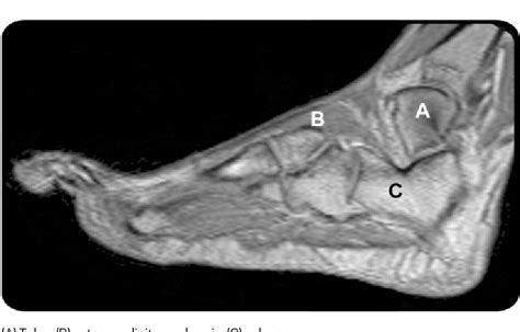 Mri patterns of neuromuscular disease involvement thigh & other muscles 2. Foot Muscles Mri / MRI anatomy of hip joint | free MRI ...