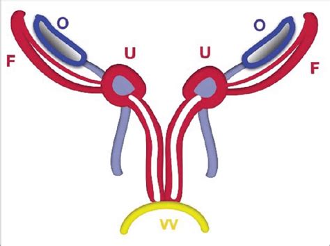 Maybe you would like to learn more about one of these? Schematic Stage of Duplicated Uterus. The uterus (U) and ...