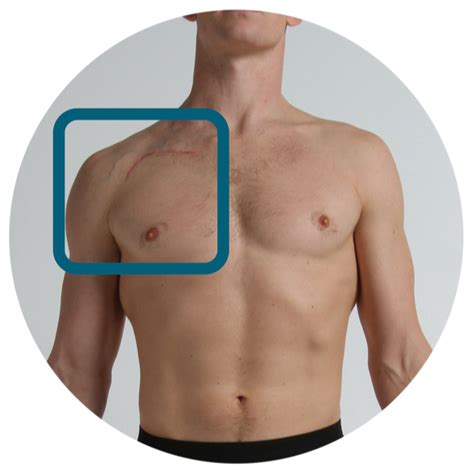 Shoulder tendonitis leads to shoulder joint problems. Shoulder Tendons Chart - Shoulder Range Of Motion Chart ...