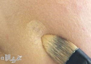 フェイスラインにできるニキビ。原因と対策は？ ｜ お悩み別 ...