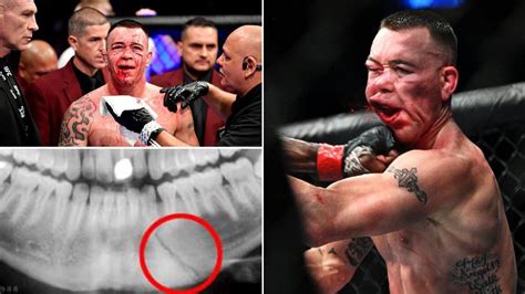 Dato' seri vida pasrah dan terima ketentuan | h.o.t mg. La vida de «caos» de Colby Covington | | Superluchas