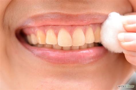 Aphthous stomatitis, also commonly known as canker sores are tiny red bumps that appear inside the mouth, on the lips, the inner cheeks, inside the throat and on the tongue. Heal a Cold Sore Naturally | Cold sore, Home remedies cold ...