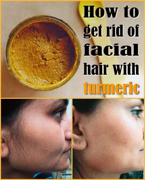 Facial hair growth is sometimes caused by pcos. How to Get Rid Of Unwanted Facial Hair Naturally - For ...