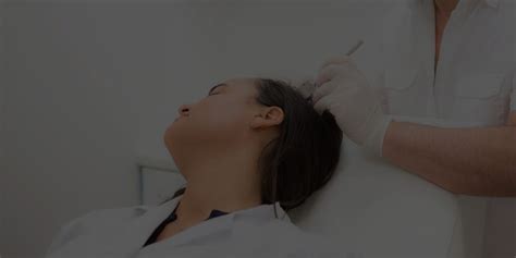 Ziering medical now administers exosome scalp injections, and below we will explain the mechanisms of the treatment and what. Microneedling Hair Growth in Los Gatos and San Jose | Sani ...