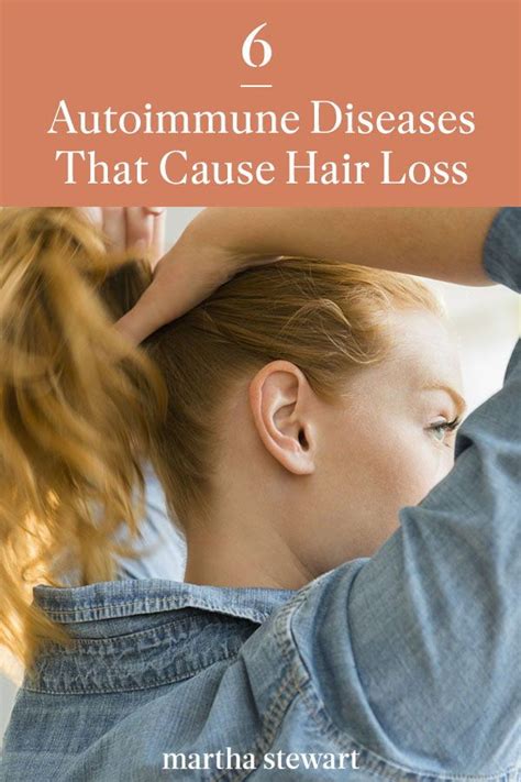 To do that, you eat foods that. Six Autoimmune Diseases That Cause Hair Loss | Hair loss ...