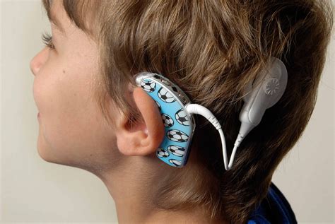 Different appliances can require a different supply. How Long do Batteries Last in a Cochlear Implant? | by ...