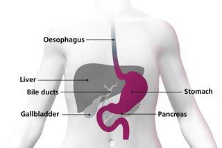 The cancerous cells can invade and destroy surrounding healthy tissue, including organs. Symptoms of stomach cancer - NHS