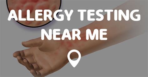 Certain companies are now offering food. ALLERGY TESTING NEAR ME - Points Near Me